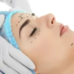 PLASTIC SURGERY